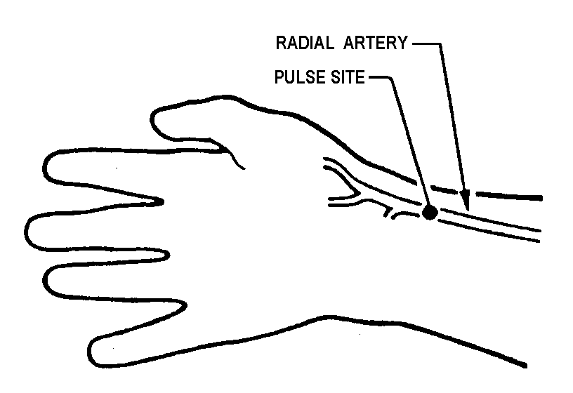 Radial Pulse